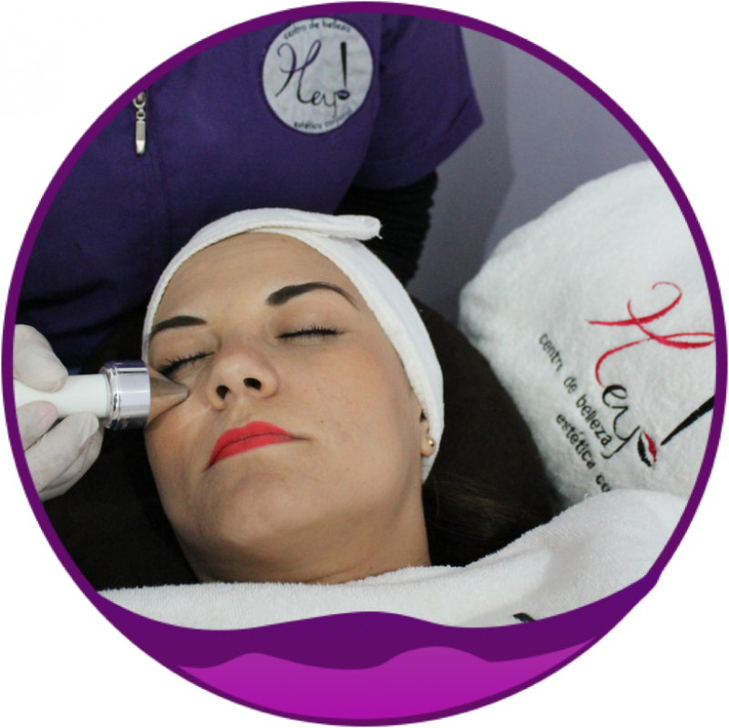 Ultrasonido Facial